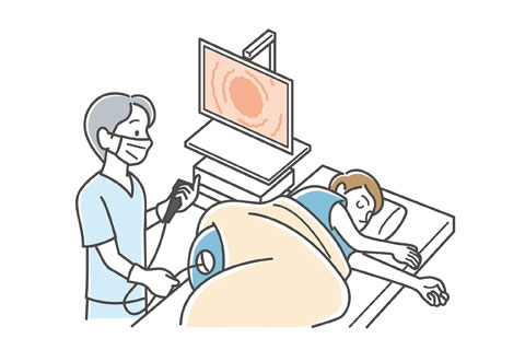 大腸カメラ検査